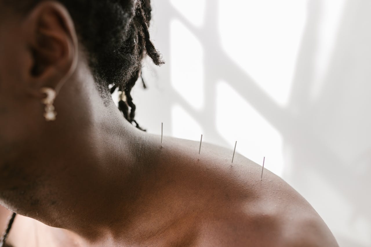 ABC Wellness Acupuncture Therapy